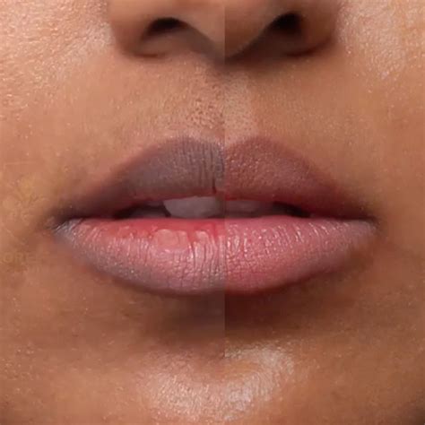 picture of a lips